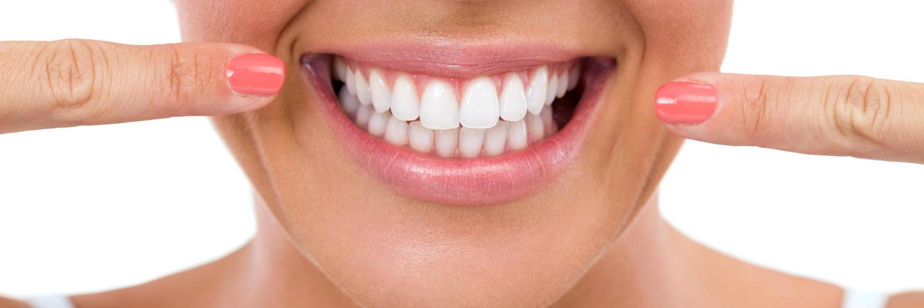 close up of bright smile l teeth cleaning smyrna ga