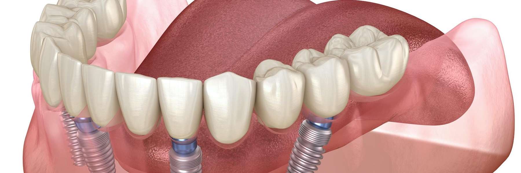 smyrna ga dentist